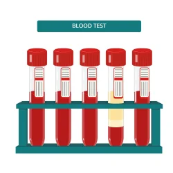 blood_testing_1